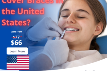 Can Insurance Cover Braces in the United States?