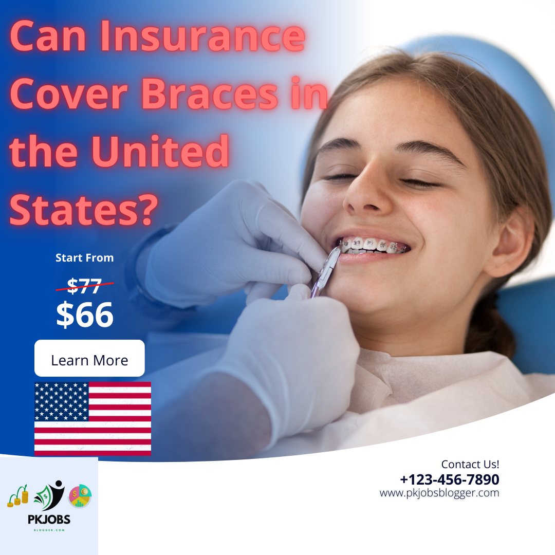 Can Insurance Cover Braces in the United States?